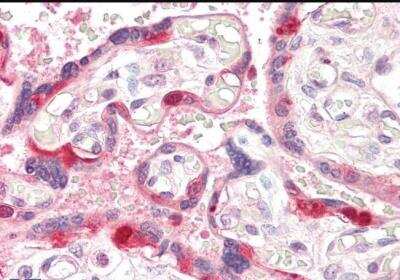 Immunohistochemistry-Paraffin: ARHGEF5 Antibody [NB100-2559]