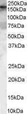 Western Blot: ARHGEF5 Antibody [NB100-2559]