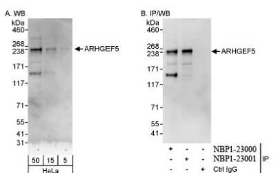 Western Blot: ARHGEF5 Antibody [NBP1-23000]