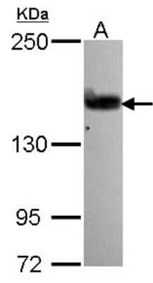 Western Blot: ARHGEF5 Antibody [NBP2-15457]