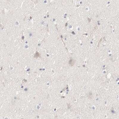 Immunohistochemistry-Paraffin: ARHGEF6 Antibody [NBP1-89124]