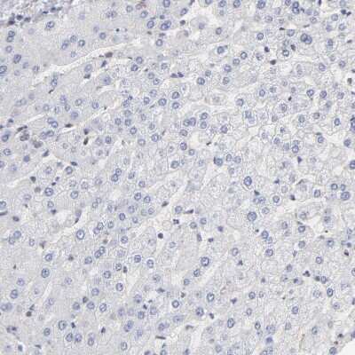 Immunohistochemistry-Paraffin: ARHGEF6 Antibody [NBP1-89124]