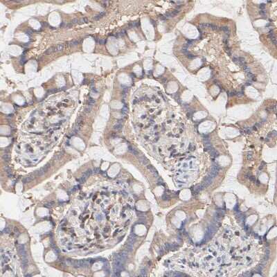 Immunohistochemistry-Paraffin: ARHGEF6 Antibody [NBP1-89124]