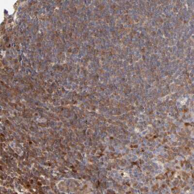 Immunohistochemistry-Paraffin: ARHGEF6 Antibody [NBP1-89124]