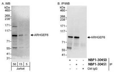 Western Blot: ARHGEF6 Antibody [NBP1-30450]