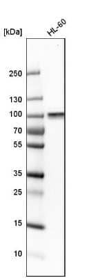 Western Blot: ARHGEF6 Antibody [NBP1-89124]