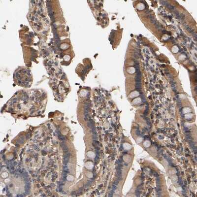 Immunohistochemistry-Paraffin: ARHGEF7 Antibody [NBP1-88650]