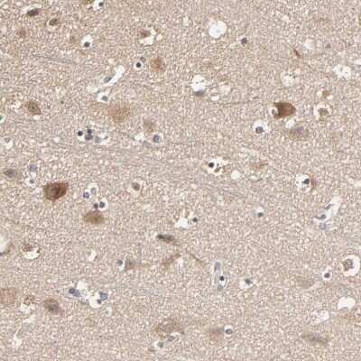 Immunohistochemistry-Paraffin: ARHGEF7 Antibody [NBP1-88650]