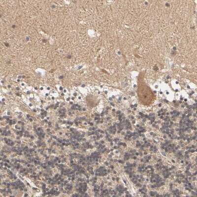 Immunohistochemistry-Paraffin: ARHGEF7 Antibody [NBP1-88650]