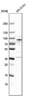 Western Blot: ARHGEF7 Antibody [NBP1-88650]