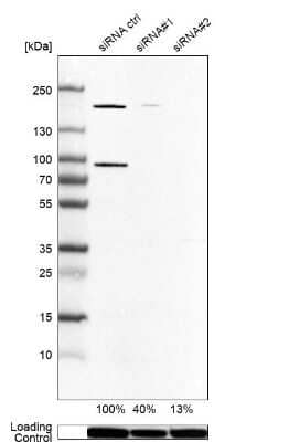 Western Blot: ARHGEF7 Antibody [NBP1-88650]