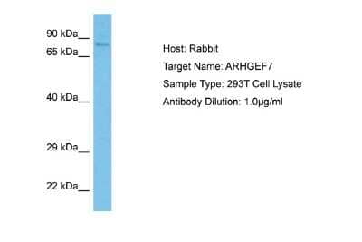 Western Blot: ARHGEF7 Antibody [NBP2-84456]