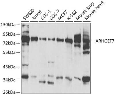 Western Blot: ARHGEF7 AntibodyBSA Free [NBP2-92602]