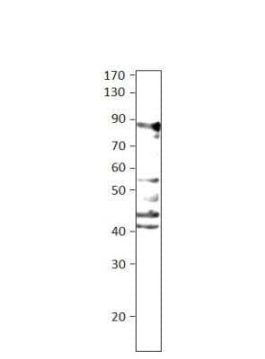 Western Blot: ARHGEF7 Antibody [NBP3-12453]