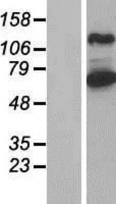 Western Blot: ARHGEF7 Overexpression Lysate [NBP2-05464]