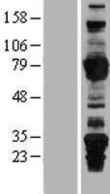 Western Blot: ARHGEF7 Overexpression Lysate [NBP2-07939]