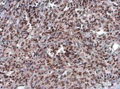 Immunohistochemistry-Paraffin: ARID1A Antibody (3611) [NBP2-43566]