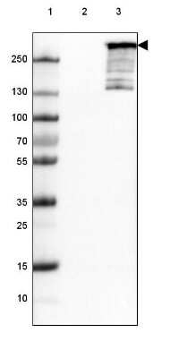 Western Blot: ARID1A Antibody (CL3595) [NBP2-61623]