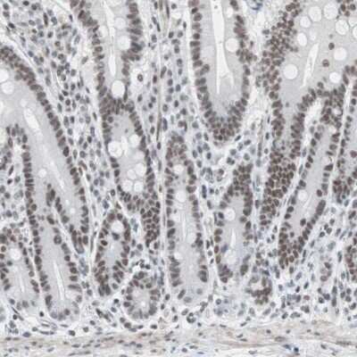 Immunohistochemistry-Paraffin: ARID1A Antibody [NBP1-88932]