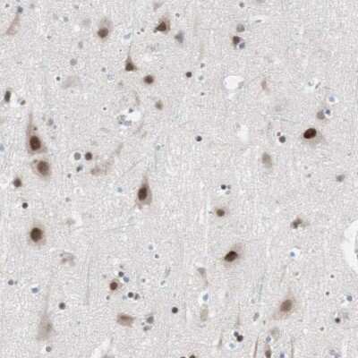 Immunohistochemistry-Paraffin: ARID1A Antibody [NBP1-88932]