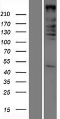 Western Blot: ARID1A Overexpression Lysate [NBP2-07670]