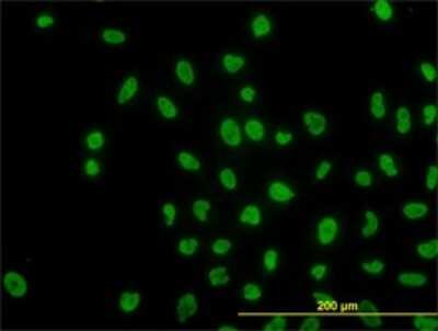 Immunocytochemistry/ Immunofluorescence: ARID1B Antibody (2D2) [H00057492-M01]