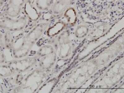 Immunohistochemistry-Paraffin: ARID1B Antibody (2D2) [H00057492-M01]