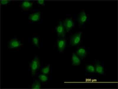 Immunocytochemistry/ Immunofluorescence: ARID1B Antibody (2F2) [H00057492-M02]
