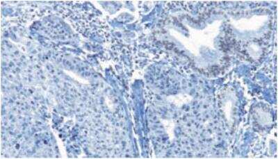 Immunohistochemistry-Paraffin: ARID1B Antibody (2F2) [H00057492-M02]