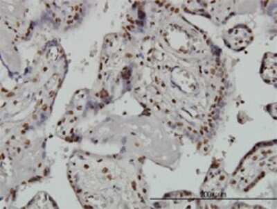 Immunohistochemistry-Paraffin: ARID1B Antibody (2F2) [H00057492-M02]