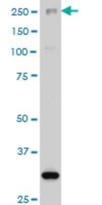 Western Blot: ARID1B Antibody (2F2) [H00057492-M02]