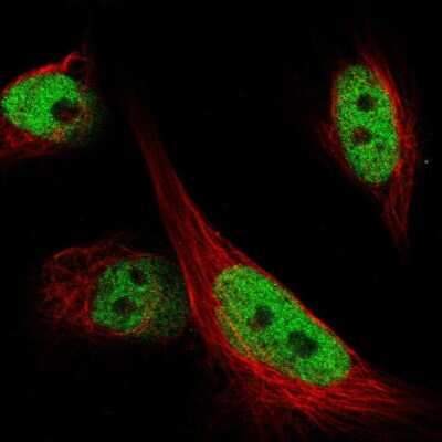 Immunocytochemistry/ Immunofluorescence: ARID1B Antibody [NBP1-89358]