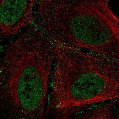 Immunocytochemistry/ Immunofluorescence: ARID1B Antibody [NBP2-57946]