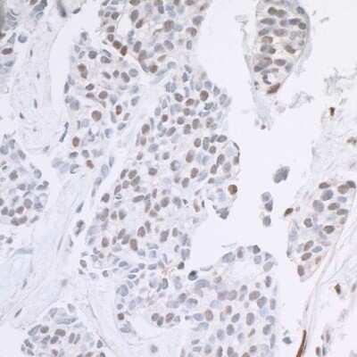 Immunohistochemistry-Paraffin: ARID1B Antibody [NB100-57484]