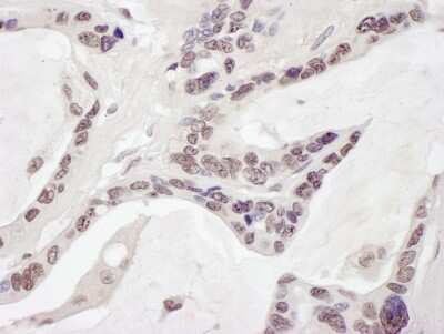 Immunohistochemistry: ARID1B Antibody [NB100-57485]