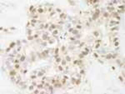 Immunohistochemistry-Paraffin: ARID1B Antibody [NB100-57485]