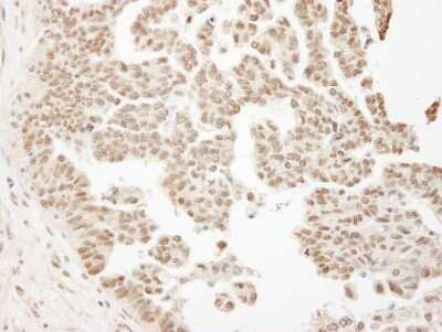 Immunohistochemistry-Paraffin: ARID1B Antibody [NB100-57485]