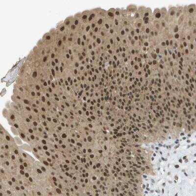 Immunohistochemistry-Paraffin: ARID1B Antibody [NBP1-89358]