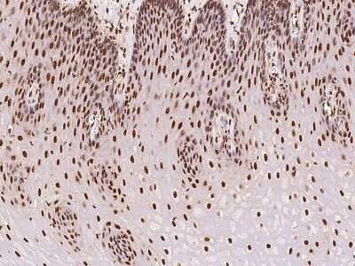 Immunohistochemistry-Paraffin: ARID1B Antibody [NBP2-97890]