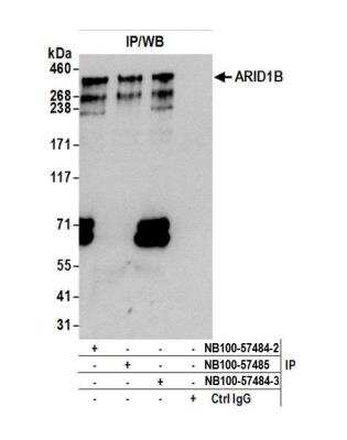 Immunoprecipitation: ARID1B Antibody [NB100-57484]