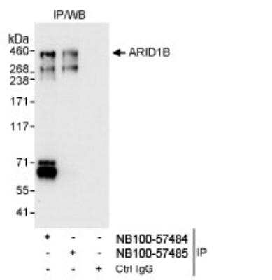 Immunoprecipitation: ARID1B Antibody [NB100-57485]