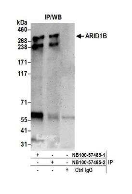 Immunoprecipitation: ARID1B Antibody [NB100-57485]