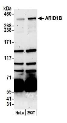 Western Blot: ARID1B Antibody [NB100-57484]