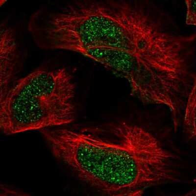 Immunocytochemistry/ Immunofluorescence: ARID2 Antibody [NBP2-57220]