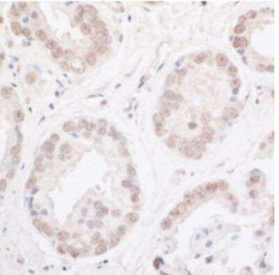 Immunohistochemistry-Paraffin: ARID2 Antibody [NBP1-26615]