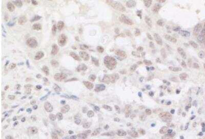 Immunohistochemistry-Paraffin: ARID2 Antibody [NBP1-26615]