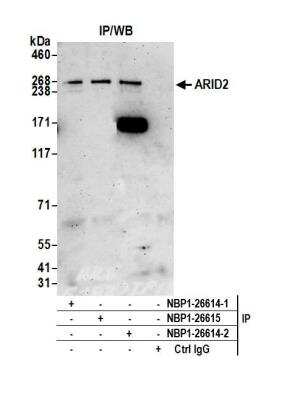 Immunoprecipitation: ARID2 Antibody [NBP1-26614]