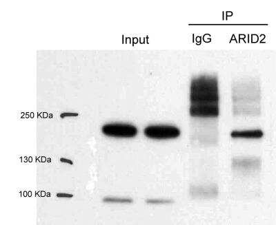 Immunoprecipitation: ARID2 Antibody [NBP1-26615]