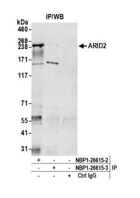Immunoprecipitation: ARID2 Antibody [NBP1-26615]
