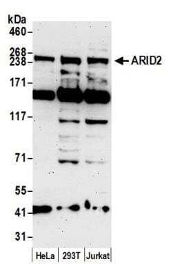 Western Blot: ARID2 Antibody [NBP1-26614]